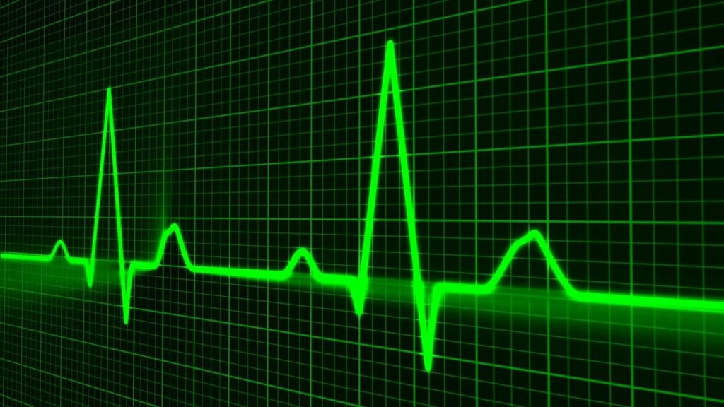 В Новосибирске изучают молекулярно-генетические маркеры, указывающие на предрасположенность к внезапной сердечной смерти