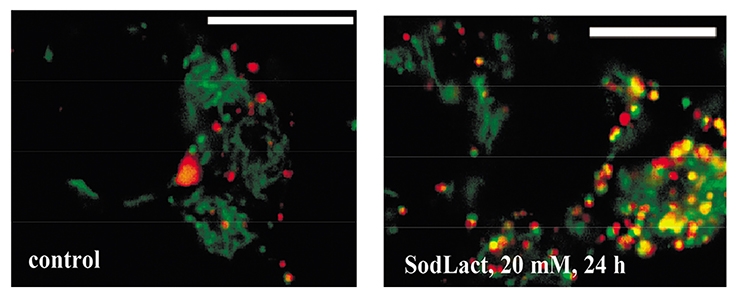 Активацию митофагии на клеточной модели болезни Паркинсона под действием лактата и пирувата показали ученые ИБК РАН ФИЦ ПНЦБИ РАН