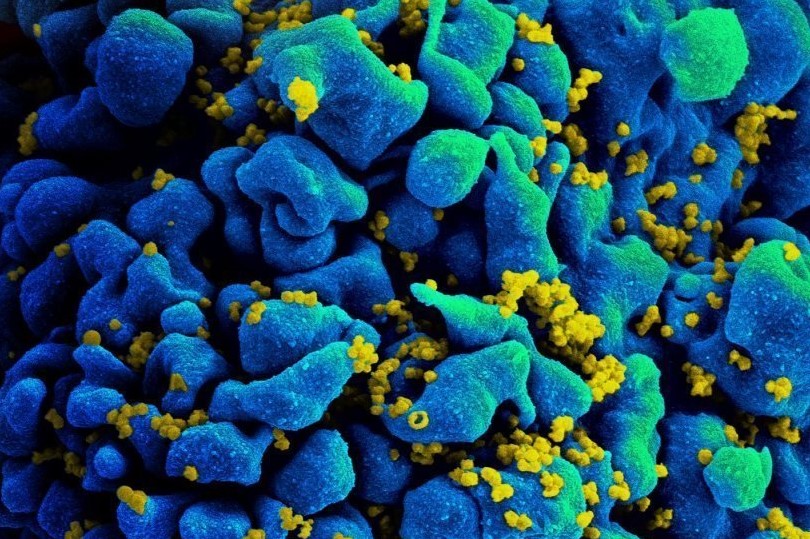 Один из белков ВИЧ способствует возникновению лимфом