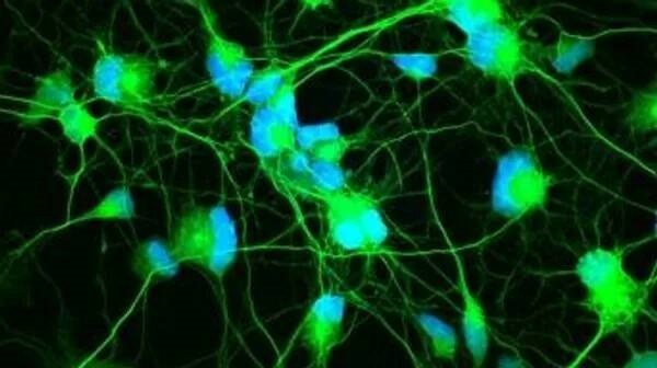 Российские ученые улучшили метод получения нейронов для лечения болезни Альцгеймера