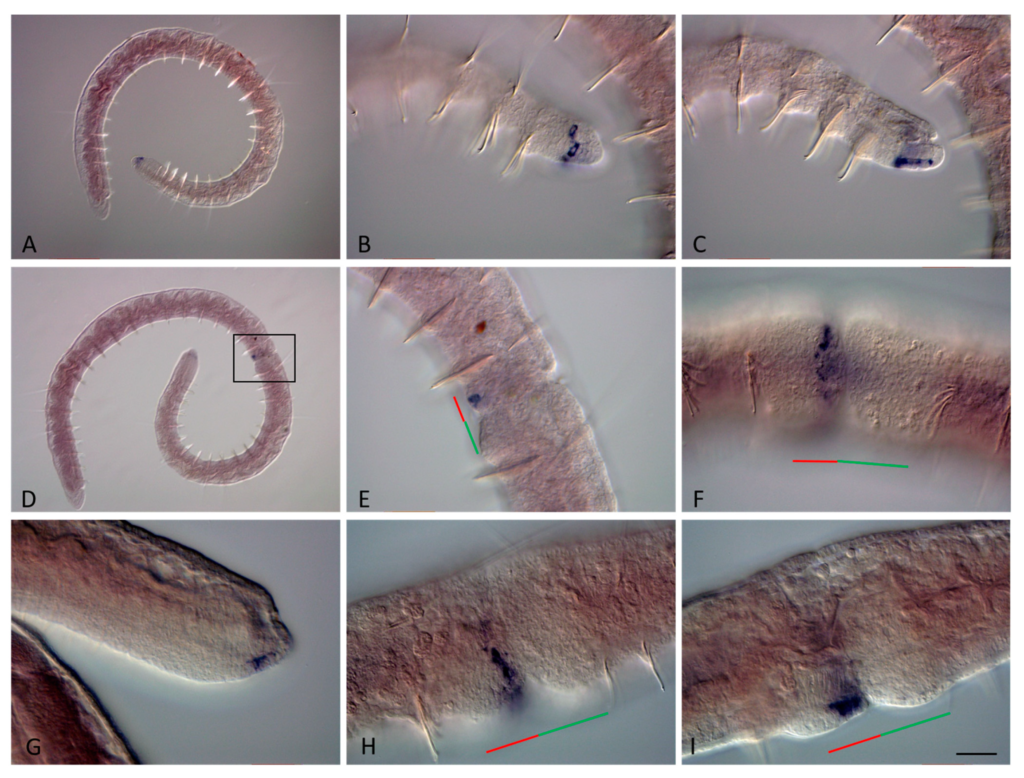Гены ParaHox помогают червям выращивать недостающие части организма