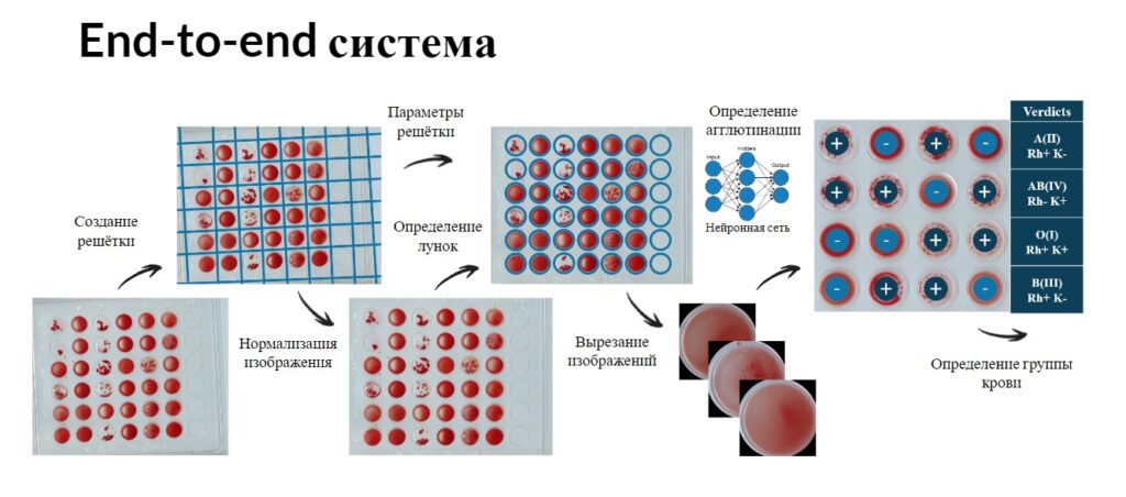 Ученые МФТИ и ИППИ РАН разработали систему для экспресс-диагностики группы крови